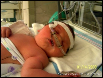 first day nicu