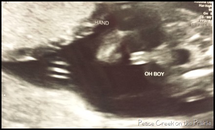 Those aren't girl parts 